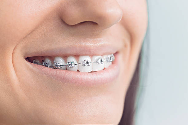 Dental Bonding in Harveys Lake, PA